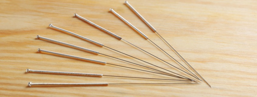 Anoka Acupuncture with Aleesha D Ackerman