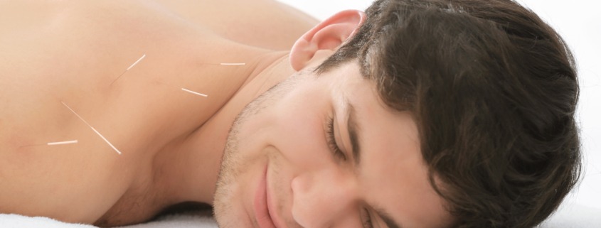 Acupuncture Helps Back Pain in Anoka at Aleesha D Acupuncture.